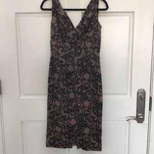 Stop staring lace dress